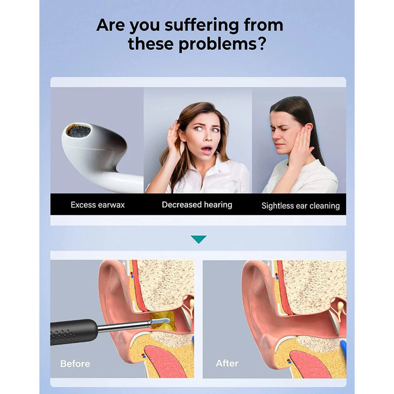 Bebird R1 + R3 T15 M9S nettoyeur d'oreille visuel intelligent Otoscop